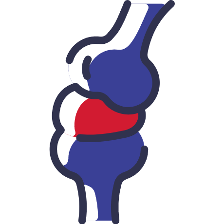 Arthritis Arthritis